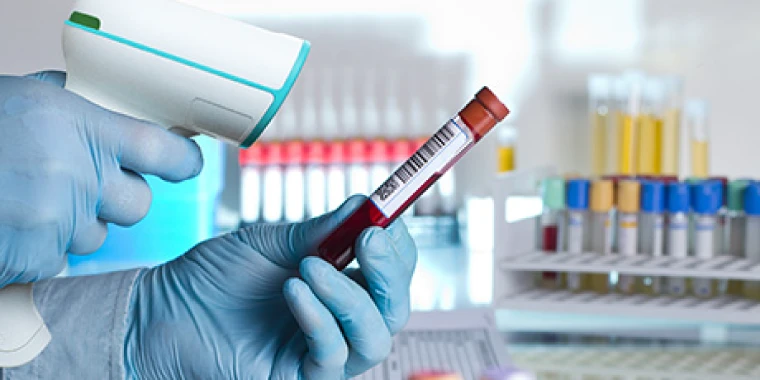 手ブレや移動体読み取りに強い